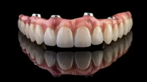 The Impact of Stress Management on Dental Implant Success